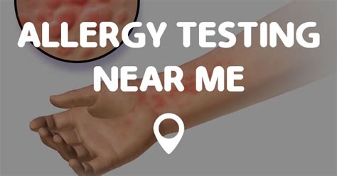 Oxford biomedical technologies is the true leader in the field of food sensitivity testing, therapy, training and technology development. ALLERGY TESTING NEAR ME - Points Near Me