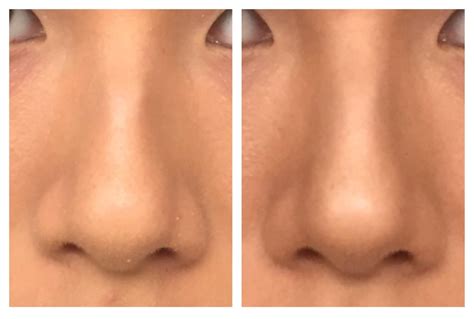 The 'nose job' nose contour | how to contour a big + crooked nose. I finally learned how to contour out my nose bump! B/A (With images) | Nose makeup, Nose ...