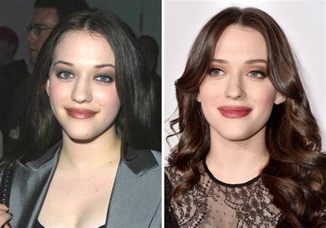 Book your cosmetic surgery now: Kat Dennings, Before and After - Beautyeditor