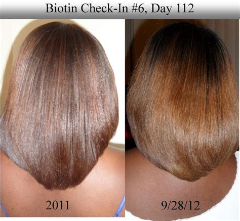 The main minerals and vitamins that work to promote fast growing, luscious hair include: Biotin Hair Growth Results Before and After | Hair ...