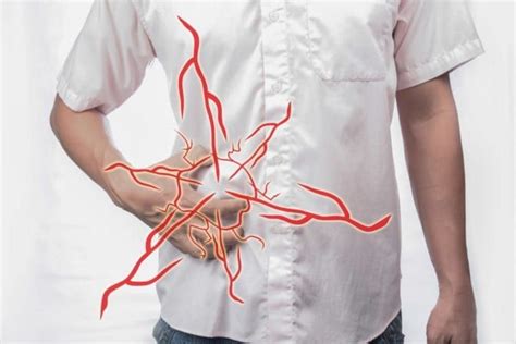 Are you suffering from ongoing complications with a hernia mesh implant? Hernia Mesh Legal Action - All That You Need to Know ...