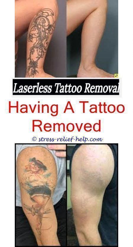 Having said that, there are several methods of tattoo removal which have proven effective. tattoo ink how to remove lip tattoo at home - how bad does ...