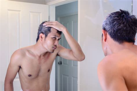 Find out which of the dry scalp treatment. How To Treat Baldness - MedExpress Health Centre