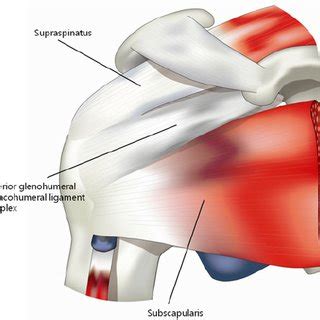 In 1986 bigliani et al. Bigliani ' s classification of acromion undersurface with ...