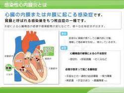 注目情報 旬の情報サイト「元気半島、ちば!」 └食のちばの逸品を発掘2021特集 「なのはな情報マガジン」臨時第16号(令和3年4月20日発行) └新型コロナウイルス感染症関連情報を. 血圧の仕組みの説明スライド - 医療のイラスト・写真・動画 ...