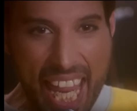 We did not find results for: What was wrong with Freddie Mercury's teeth? Why didn't he ...