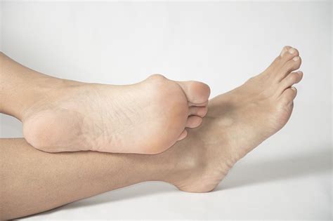 It's only at the initial stages of this condition that we can still prevent bursitis, an inflammatory process. 10 Things You Need to Know About Bunions | Cone Health ...