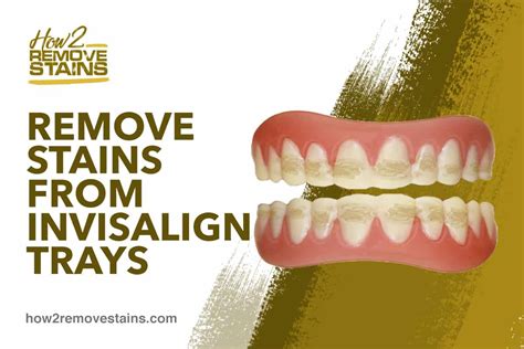 To use these invisalign cleaning crystals, fill a container with warm water (use the amount suggested in the product instructions) and pour in the right how often should you clean invisalign retainers? How to remove stains from Invisalign trays  Detailed Answer 