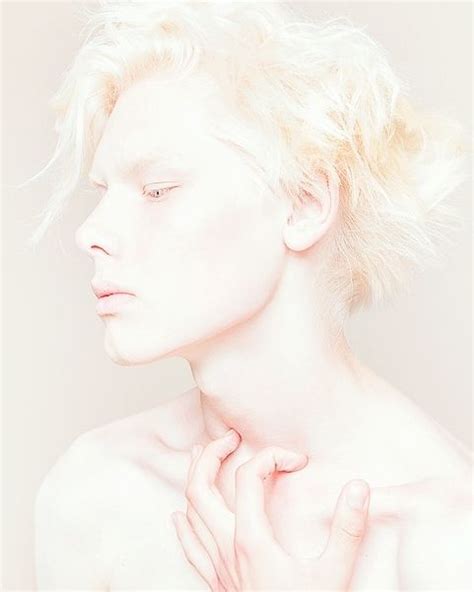 Looks like an albino.white eyelashes, white hair, albino, albinism, albino people, light skin, white eyebrows, people angels. beautiful boy, albino, white hair (With images) | Albinizm ...