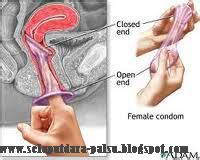 Berjuang melawan penyakit jantung bocor sejak kecil, fatih kini telah pulih. SELAPUT DARA BUATAN | ALAT BANTU SEX WANITA