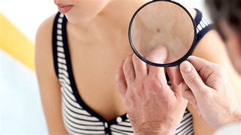 Skin cancer is the most common cancer in the united states. What Are The Signs and Symptoms of Skin Cancer? | Everyday ...