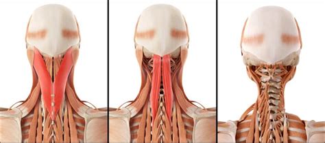 The anterior, and the posterior, triangles of the neck. Why Neck Training Should Be a Priority for Athletes