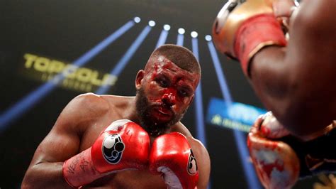 Hd pic of the cut from badou jack vs marcus browne. Badou Jack makes light of bloody cut sustained in loss to ...