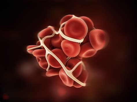Asked And Answered : All About Thrombophilia Pregnancy | Cloudnine BlogAsked and Answered: All 