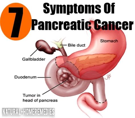 When someone with pancreatic cancer dies. 7 Symptoms Of Pancreatic Cancer - How To Recognize ...