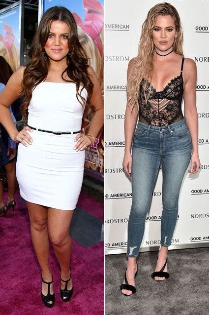 Khloé Kardashian Before - Before And After Kardashian Plastic Surgery 