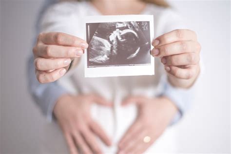 Karena menurutnya, bentuk perut hamilnya terkesan melebar, yang diyakini oleh masyarakat menunjukkan bayi perempuan. Gambar Hasil Usg Janin Perempuan : Cara Memilih Jenis ...