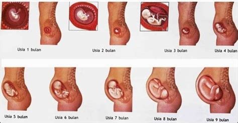 Anda mungkin akan mengeluarkan biaya yang tidak sedikit, dikarenakan anda belum tahu berapa botol sprite untuk menggugurkan kandungan? Perkembangan Bayi Dalam Kandungan Hamil 34 Minggu