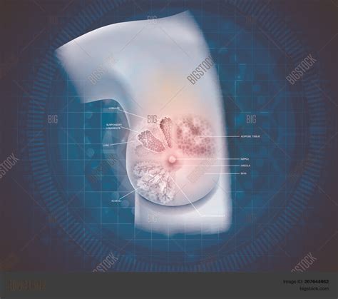 Advantages high sensitivity for adenopathy, infiltrates, and architectural distortion. Diagram Of Female Chest Area : Sternum Wikipedia - After showing this chest on human body male i ...