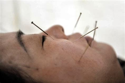 Acupuncture is a form of alternative medicine and a key component of traditional chinese medicine (tcm) in which thin needles are inserted into the body. Mein erstes Mal...bei der Akupunktur