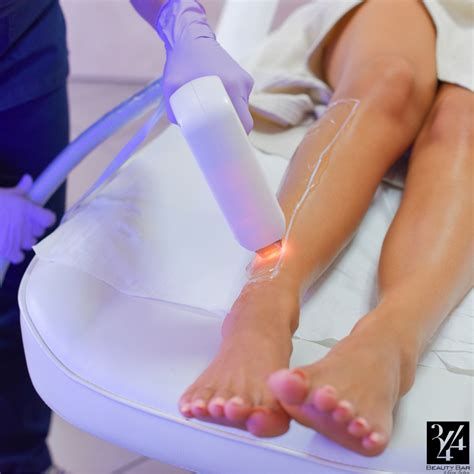 What to do after a cast is removed? Laser Hair Removal- The Need to Know Before Treatment ...