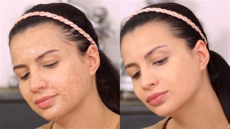 Die besten masken zum abziehen im vergleich. DIY ANTI PICKEL MASKE Maske gegen Pickel akne und Mitesser ...