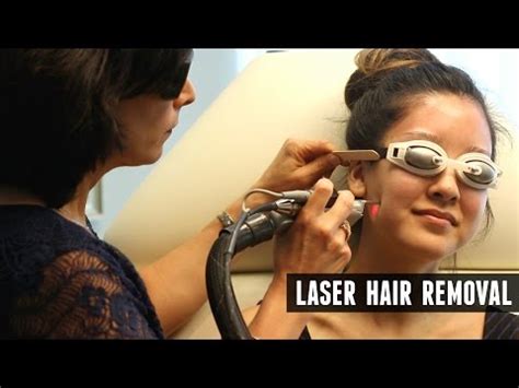 So, ipl and laser hair removal is not recommended for teens. Laser Hair Removal Experience + Q&A! - YouTube