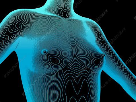 Check spelling or type a new query. Female body contour map - Stock Image F017/3768 - Science ...