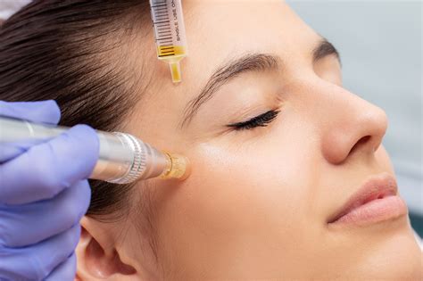 While it was first approved in 2002 to treat frown lines, the fda then approved botox for improving crow's feet wrinkles in 2013. Using Botox to Treat Crow's Feet - Skin Perfections RGV
