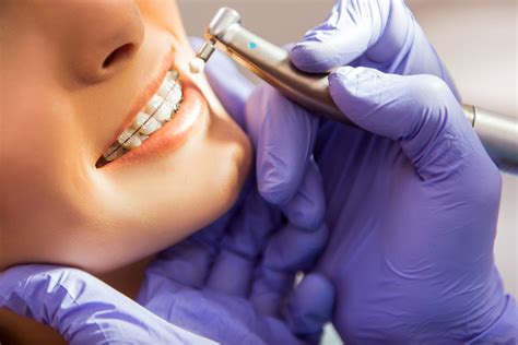 Childrens dental care and orthodontics. Why Both Dental and Orthodontic Care Are Important - Hardy ...