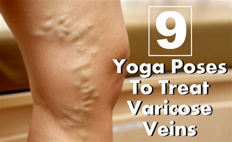 Check spelling or type a new query. Top 9 Yoga Poses To Treat Varicose Veins | Find Home ...