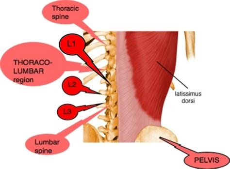 A few of these are: noahboat | MAIGNES SYNDROME / supereior cluneal nerves ...