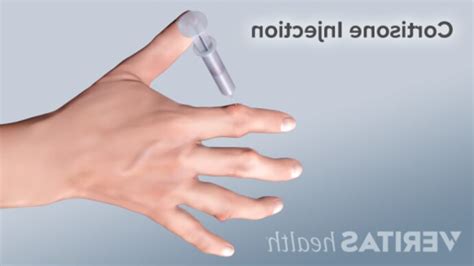Cortisone usato in Italia | vedi tutte i 39 prezzi!
