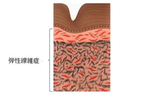 産後の悩みに膣縮小術。女医が在籍するクリニック紹介 | Call to ...
