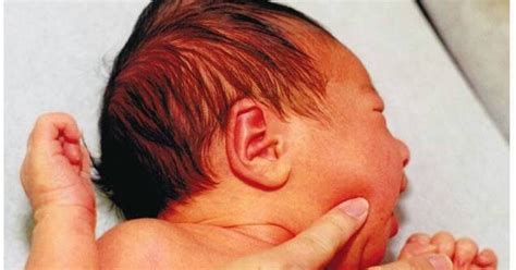 Biang keringat atau keringat buntet (prickle heat) dapat terjadi pada siapa saja, baik pada bayi maupun orang dewasa. informasi praktis kesehatan anak: Benjolan pada Kepala ...