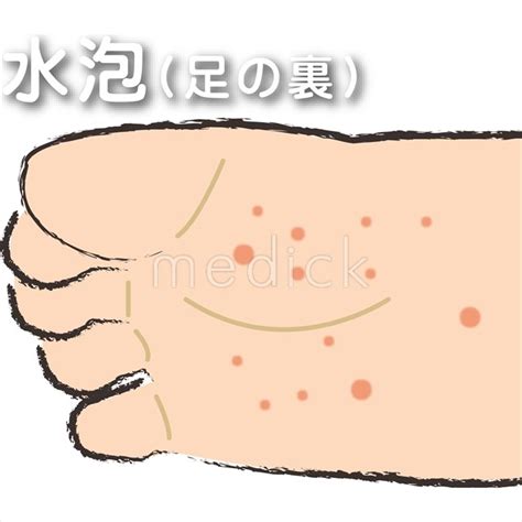 【100+】 足の裏 イラスト - 無料の印刷可能な画像