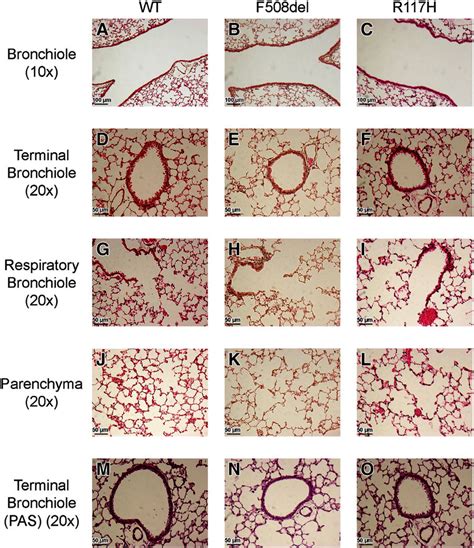 Quantitative ct analysis of lung parenchyma. Histologic analysis of the airways and lung parenchyma ...