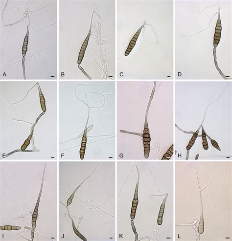 Chain of conidia of alternaria. Alternaria passiflorae: conidia and conidiophores. A-B ...