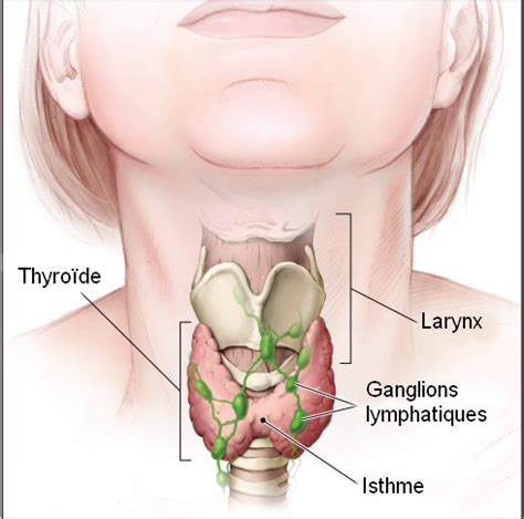 Le cancer de la thyroïde comporte la croissance des cellules anormale dans la glande thyroïde dans le col. Qu'est-ce que c'est que la thyroïde? | Mon récit radioactif