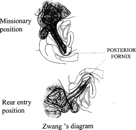 A noun is a word referring to a person, animal, place, thing, feeling or idea (e.g. Zwang (1990) diagram | Download Scientific Diagram