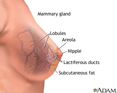 The classic description of a breast cancer is a mass with an irregular shape and spiculated margin (fig. Breast cancer: MedlinePlus Medical Encyclopedia