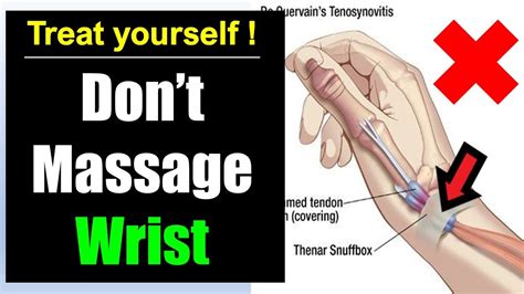 If you start treatment early, your symptoms should improve within four to six weeks. Thumb wrist pain relief: How to fix De quervain's ...