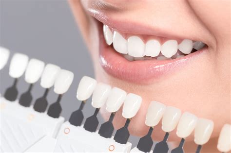 All of this adds up to an. What Are Veneers and How Do They Work?