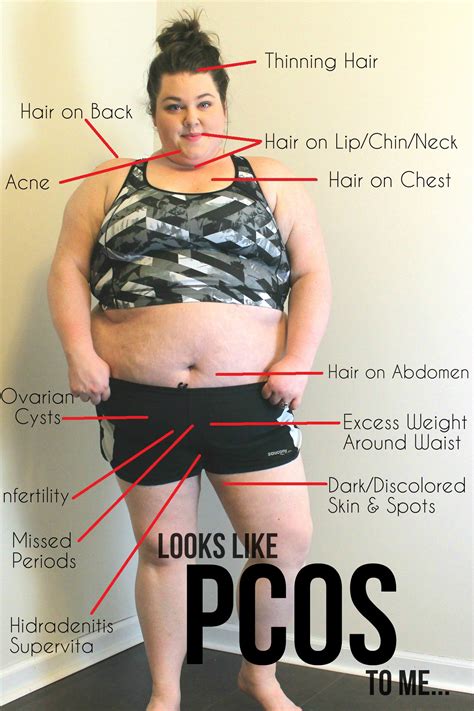 Ovarian cancer is one of the deadliest cancers a woman can get, and research suggests that women don't always recognize the symptoms. Looks Like PCOS to Me: A Visual Guide to Polycystic ...