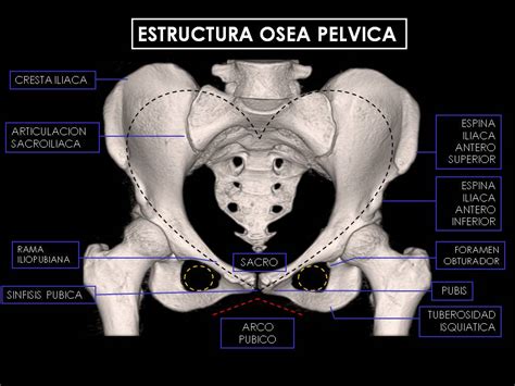 The cause of the predominantly sinistral occurrence of thrombosis of the pelvic veins. EPOS™ - S-0042