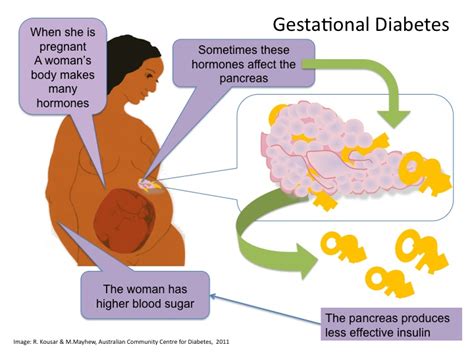Diabetes semasa hamil atau gestational diabetes mellitus (gdm) merupakan satu kondisi serius yang menyerang wanita hamil yang sebelum ini mungkin tidak mempunyai sejarah perubatan menghidapi diabetes. CARA ATASI PENYAKIT KENCING MANIS SEMASA HAMIL AGAR TIDAK ...