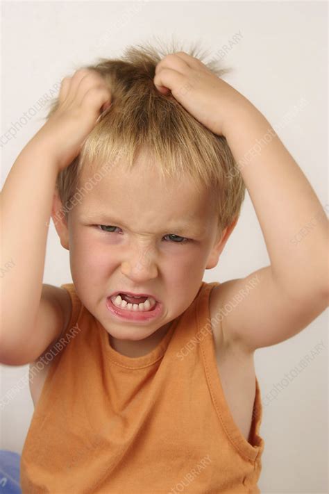 Louse child - Stock Image - C004/4530 - Science Photo Library
