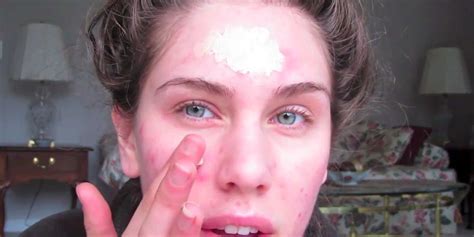 Then, apply it directly to a cystic pimple, zeichner explains. How To Get Rid of Cystic Acne for Good | Cystic acne, Diy ...