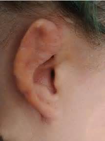 0 out of 5 based on 0 customer ratings. Woman left with mutilated ears after surgery to make her ...