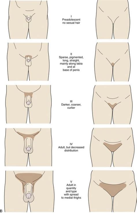 When it comes to pubic hair removal, shapes, and designs, men have just as many options as women. Endocrinology | Obgyn Key